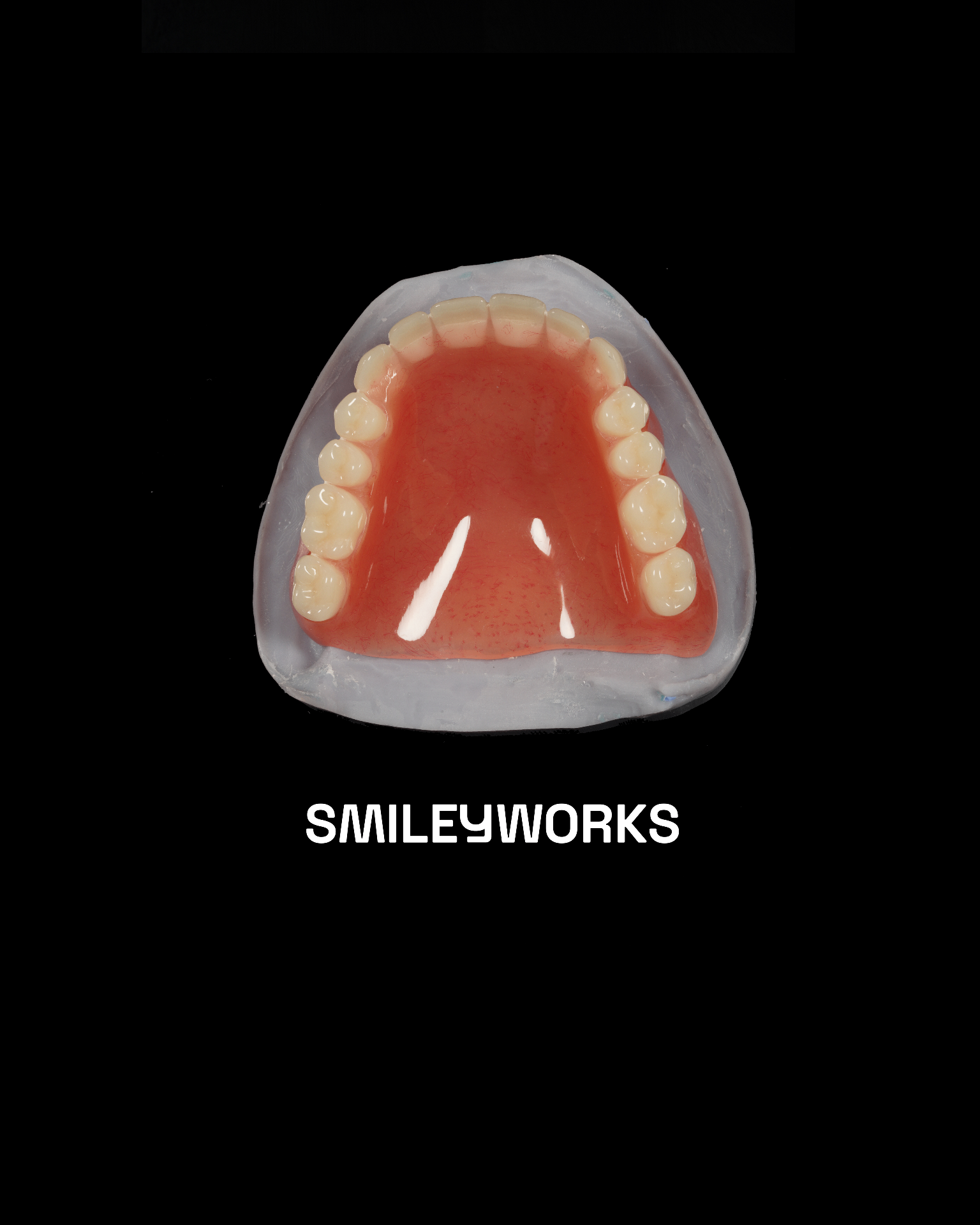 Full Upper Acrylic Denture